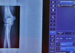 Další přelom v krajském zdravotnictví. Kraj kupuje společnost DIMED